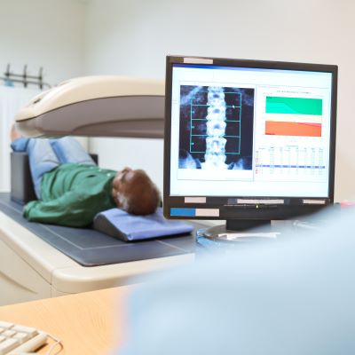 osteoporose-vorsorge-istockphoto-quadrat